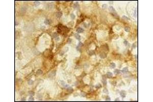 Immunohistochemistry (IHC) image for anti-CD209 (CD209) (Extracellular Domain) antibody (ABIN492510) (DC-SIGN/CD209 Antikörper  (Extracellular Domain))