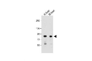 All lanes : Anti-MUT Antibody (N-Term) at 1:2000 dilution Lane 1: Human liver lysate Lane 2: Mouse liver lysate Lysates/proteins at 20 μg per lane. (MUT Antikörper  (AA 32-66))
