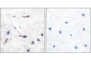 Immunohistochemistry analysis of paraffin-embedded human brain tissue, using MARCKS (Ab-163) Antibody. (MARCKS Antikörper  (AA 136-185))