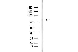 Western blot analysis of lysates from Hela cells(heat-shock,45 min treatment), using LRP1/C Antibody at 1/1000 dilution.