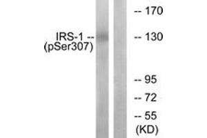 Western Blotting (WB) image for anti-Insulin Receptor Substrate 1 (IRS1) (pSer307) antibody (ABIN2888447) (IRS1 Antikörper  (pSer307))
