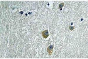 Immunohistochemistry (IHC) analyzes of PAKalpha antibody in paraffin-embedded human brain tissue. (PAK1 Antikörper)
