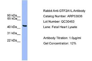 WB Suggested Anti-GTF2A1L  Antibody Titration: 0. (GTF2A1L Antikörper  (C-Term))