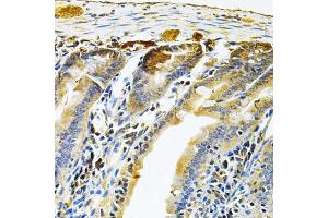 Immunohistochemistry of paraffin-embedded mouse intestine using RRAGC Antibody (ABIN5975563) at dilution of 1/100 (40x lens). (GTR2 Antikörper)