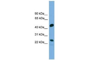 WB Suggested Anti-CDCA4 Antibody Titration:  0.