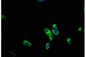 Immunofluorescence staining of HepG2 cells with ABIN7163295 at 1:200, counter-stained with DAPI. (PIK3R5 Antikörper  (Regulatory Subunit 5))