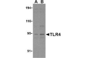 Image no. 1 for anti-Toll-Like Receptor 4 (TLR4) (N-Term) antibody (ABIN951277) (TLR4 Antikörper  (N-Term))