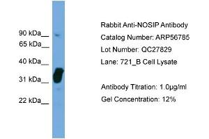 WB Suggested Anti-NOSIP  Antibody Titration: 0. (NOSIP Antikörper  (Middle Region))