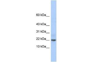 WB Suggested Anti-C9orf25 Antibody Titration: 0. (C9orf25 Antikörper  (Middle Region))