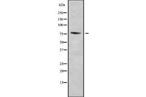 Western blot analysis of ZNF7 using COLO205 whole cell lysates (ZNF7 Antikörper  (Internal Region))