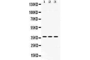 Western blot analysis of GNB1 expression in rat liver extract ( Lane 1), mouse cardiac muscle extract ( Lane 2) and HELA whole cell lysates ( Lane 3).