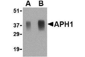 Western Blotting (WB) image for anti-Anterior Pharynx Defective 1 Homolog A (C. Elegans) (APH1A) (Middle Region) antibody (ABIN499309)