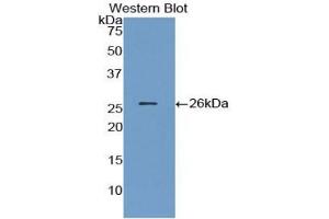 Western blot analysis of the recombinant protein. (Angiopoietin 1 Antikörper  (AA 21-228))