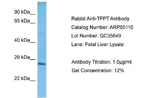 Western Blotting (WB) image for anti-TCF3 (E2A) Fusion Partner (In Childhood Leukemia) (TFPT) (C-Term) antibody (ABIN2790046) (TFPT Antikörper  (C-Term))
