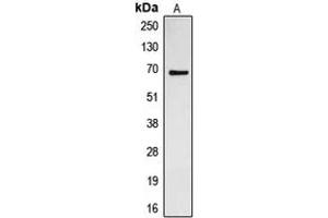 Western blot analysis of CDC23 expression in Jurkat (A) whole cell lysates. (CDC23 Antikörper  (Center))