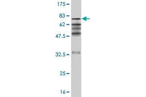 Western Blot detection against Immunogen (66. (ZNF24 Antikörper  (AA 1-368))