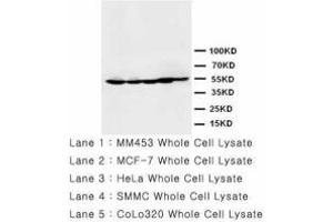 Image no. 1 for anti-Histone Deacetylase 2 (HDAC2) (AA 464-478) antibody (ABIN1493469) (HDAC2 Antikörper  (AA 464-478))