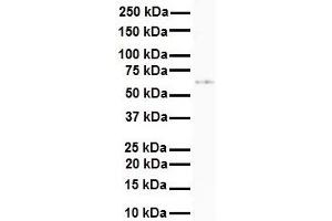 WB Suggested Anti-SLC7A1 antibody Titration: 1 ug/mL Sample Type: Human 721_B (SLC7A1 Antikörper  (N-Term))