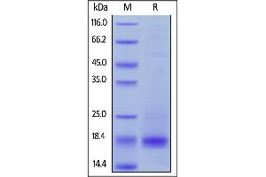 Biotinylated Human CD3 epsilon, His,Avitag on  under reducing (R) condition.