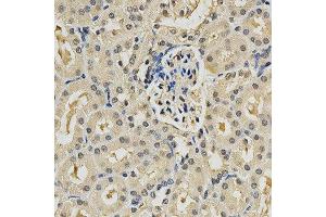Immunohistochemistry (IHC) image for anti-Proteasome (Prosome, Macropain) Subunit, beta Type, 9 (Large Multifunctional Peptidase 2) (PSMB9) (AA 1-219) antibody (ABIN3022518)
