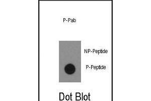 Dot blot analysis of anti-Phospho-ABL1- Antibody (ABIN389501 and ABIN2839559) on nitrocellulose membrane. (ABL1 Antikörper  (pTyr134))