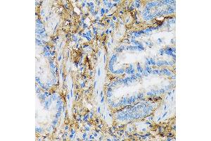 Immunohistochemistry of paraffin-embedded rat lung using Collagen VI/COL6 Rabbit mAb (ABIN7266462) at dilution of 1:100 (40x lens). (COL6A1 Antikörper)