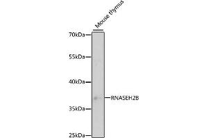 Western blot analysis of extracts of mouse thymus, using RNB antibody (ABIN6133304, ABIN6146990, ABIN6146991 and ABIN6220814) at 1:3000 dilution. (RNASEH2B Antikörper  (AA 1-290))
