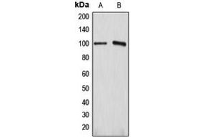 Western blot analysis of ATP1A1 expression in HEK293T (A), HeLa (B) whole cell lysates. (ATP1A1 Antikörper  (Center))