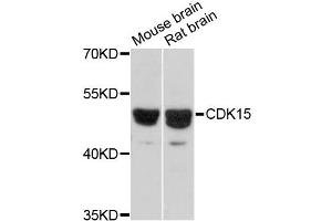 Western blot analysis of extracts of various cell lines, using CDK15 antibody (ABIN6292714) at 1:3000 dilution. (Cyclin-Dependent Kinase 15 (ALS2CR7) Antikörper)