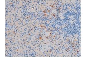 ABIN6256564 and ABIN6267470 at 1/200 staining Rat spleen tissue sections by IHC-P.