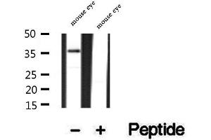 Western blot analysis of extracts of mouse eye tissue, using PRPH2 antibody. (PRPH2 Antikörper  (Internal Region))