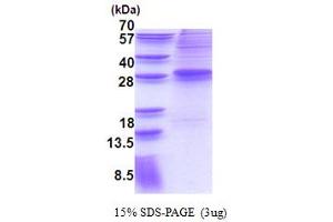 SDS-PAGE (SDS) image for MDS1 and EVI1 Complex Locus (MECOM) (AA 1-169) protein (His tag) (ABIN5778768)