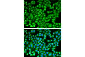 Immunofluorescence analysis of A549 cells using KAT5 antibody (ABIN6292501). (KAT5 Antikörper)