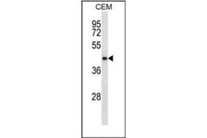 Western blot analysis of NDRG2 Antibody (N-term) in CEM cell line lysates (35ug/lane).