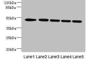 Western blot All lanes: DCXR antibody at 4. (VRK1 Antikörper  (AA 257-396))
