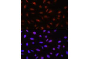 Immunofluorescence analysis of U-2 OS cells using // antibody (ABIN7265520) at dilution of 1:100. (AKT 1/2/3 Antikörper)