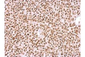 IHC-P Image BCCIP antibody detects BCCIP protein at nucleus on BT483 xenograft by immunohistochemical analysis. (BCCIP Antikörper  (C-Term))