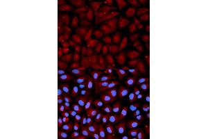 Immunofluorescence analysis of U2OS cell using SERPINC1 antibody. (SERPINC1 Antikörper  (AA 33-185))
