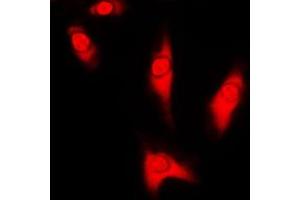 Immunofluorescent analysis of DJ-1 staining in HeLa cells. (PARK7/DJ1 Antikörper  (Center))