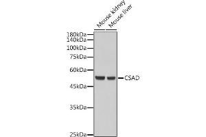 Western blot analysis of extracts of various cell lines, using CSAD antibody (ABIN6133497, ABIN6139087, ABIN6139088 and ABIN6217983) at 1:5000 dilution. (CSAD Antikörper  (AA 371-520))