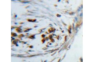 Used in DAB staining on fromalin fixed paraffin-embedded lung tissue