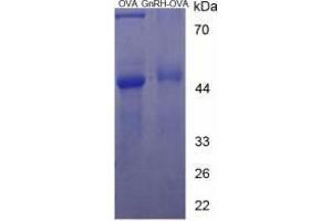 Image no. 1 for Gonadotropin-Releasing Hormone 1 (Luteinizing-Releasing Hormone) (GNRH1) peptide (Ovalbumin) (ABIN5666208) (Gonadotropin-Releasing Hormone 1 (Luteinizing-Releasing Hormone) (GNRH1) peptide (Ovalbumin))