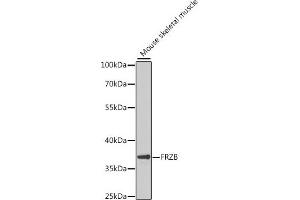 Western blot analysis of extracts of mouse skeletal muscle, using FRZB antibody (ABIN6131654, ABIN6140777, ABIN6140778 and ABIN6222275) at 1:1000 dilution. (FRZB Antikörper  (AA 166-325))