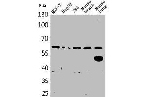 Western Blot analysis of MCF7 HepG2 293 mouse brain mouse lung cells using ZKSCAN4 Polyclonal Antibody (ZKSCAN4 Antikörper  (Internal Region))