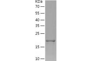 Western Blotting (WB) image for Slow Skeletal Troponin I (TNNI1) (AA 1-187) protein (His tag) (ABIN7125117)