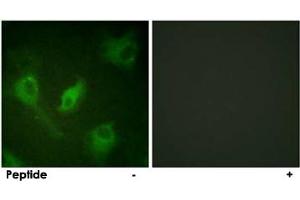 Immunofluorescence analysis of HeLa cells, using NFKBIE polyclonal antibody . (NFKBIE Antikörper)