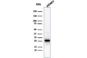 Western Blot Analysis of human kidney tissue lysate using Ferritin, Light Chain Mouse Monoclonal Antibody (FTL/1386). (FTL Antikörper  (AA 38-165))