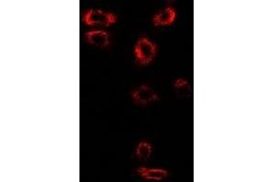 Immunofluorescent analysis of Syntenin staining in SW480 cells. (SDCBP Antikörper)