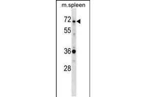 Western blot analysis in mouse spleen tissue lysates (35ug/lane). (SH3BP2 Antikörper  (AA 151-180))