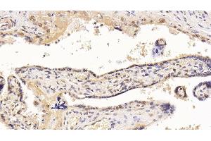 Detection of HDAC1 in Human Placenta Tissue using Monoclonal Antibody to Histone Deacetylase 1 (HDAC1) (HDAC1 Antikörper  (AA 1-482))